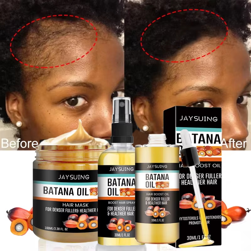 Hair Care Essence Oil Spray - バタナオイル太い髪用美容液スプレー修復ヘア栄養毛根毛包再生脱毛エッセンス男性女性ヘアケア製品