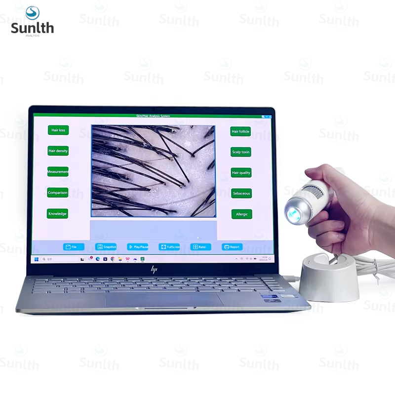レポート付き Windows システム USB 接続毛包スキ - Hair Porosity Test のレビューと価格