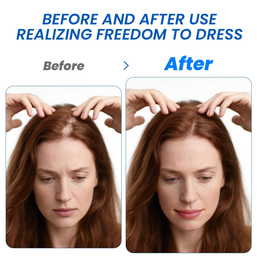 脱毛症育毛スプレー ソフォラ フラベセンス 脱毛症クリームス - Hair Care Spray のレビューと価格
