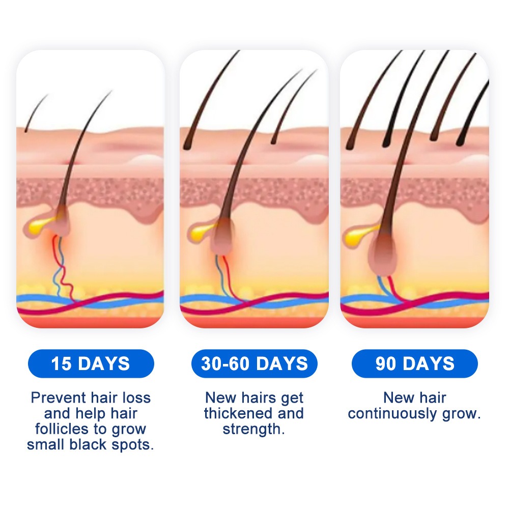 脱毛症育毛スプレー ソフォラ フラベセンス 脱毛症クリームス - Hair Care Spray のレビューと価格