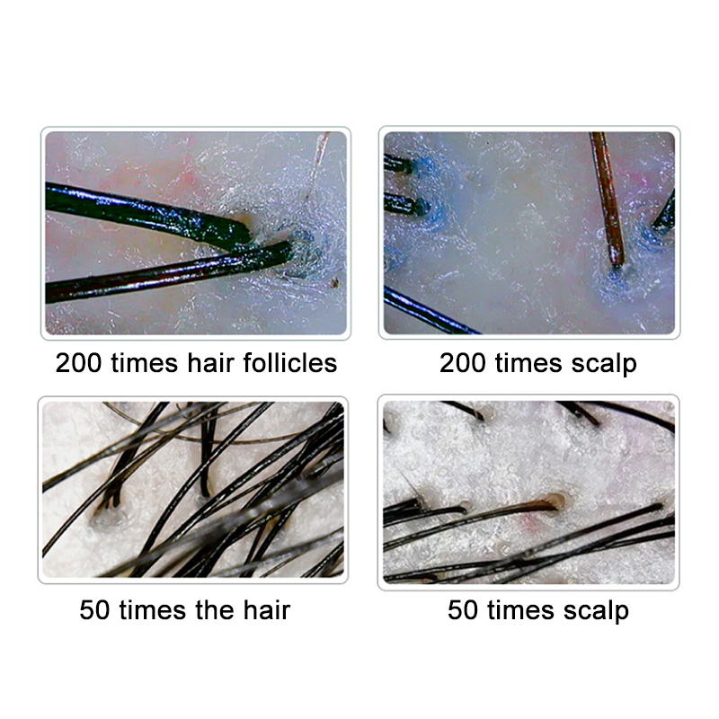 スキンヘアデージ,デジタルマイクロスコープ,HDヘア,スキン - Hair Porosity Test のレビューと価格