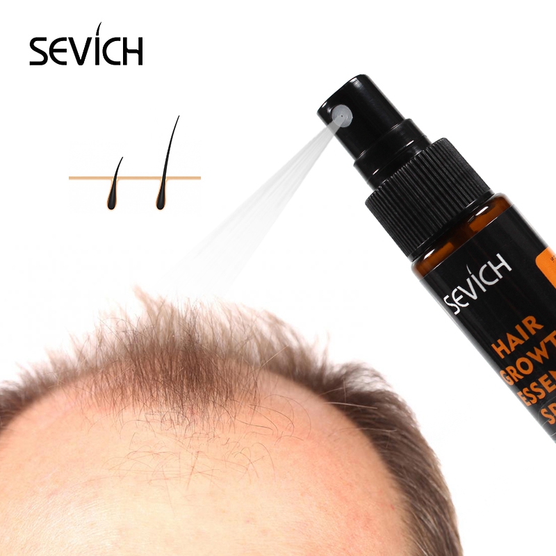 Sevich-髪の成長のためのオイルエッセンス,育毛の治療, - Hair Care Essence Oil Spray のレビューと価格