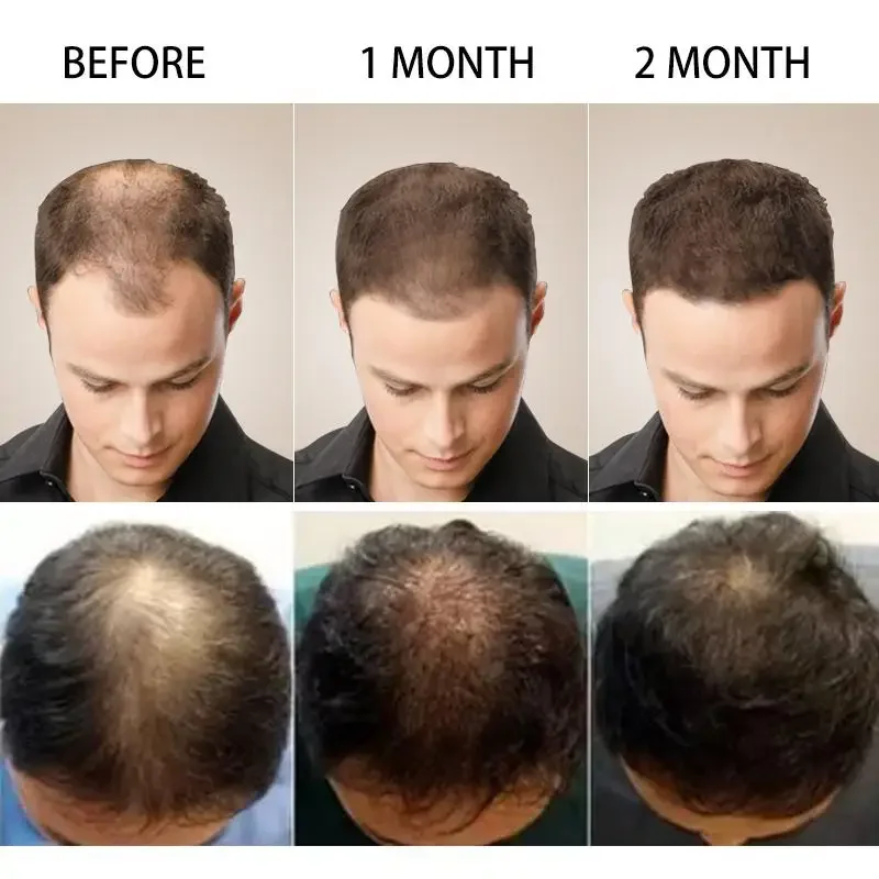 育毛ジンジャー高速成長髪エッセンシャルオイルヘアケア損失防止 - Hair Care Essence Oil Spray のレビューと価格