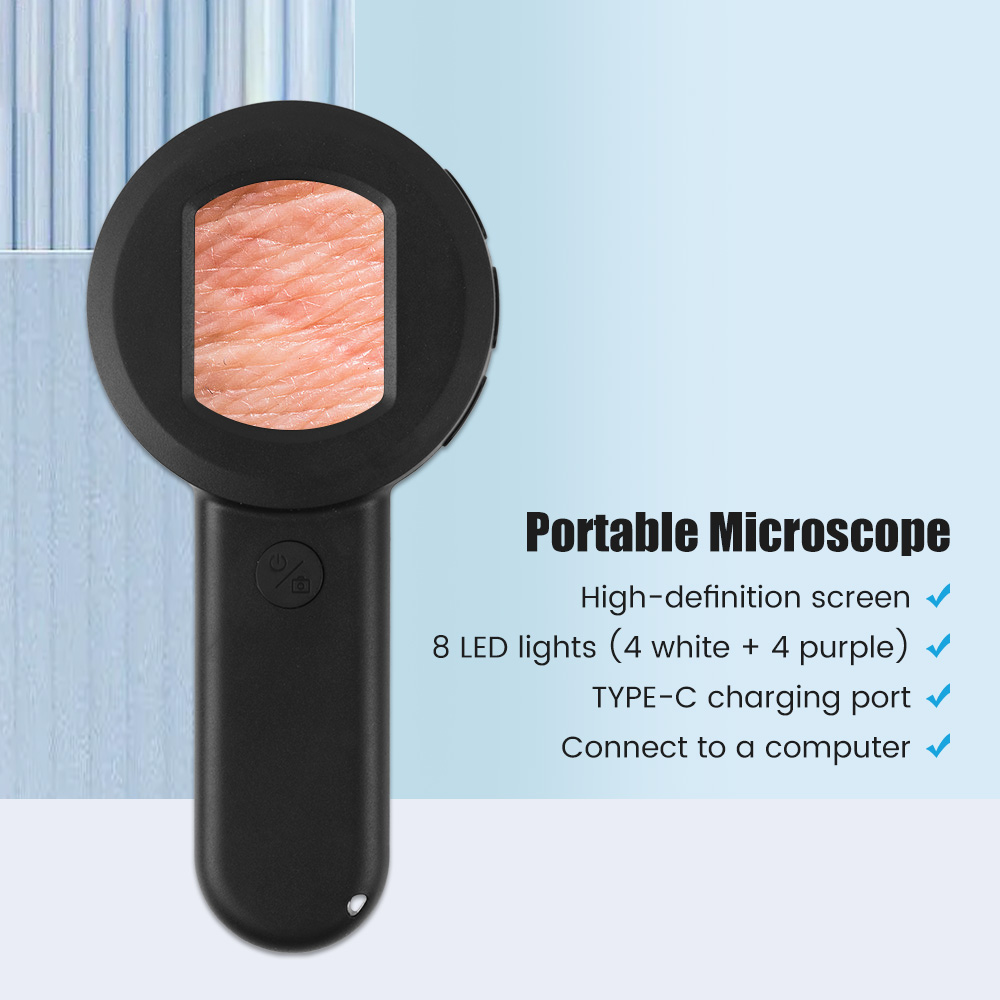 ハンドヘルド皮膚鏡、100倍拡大皮膚および頭皮アナライザー、 - Hair Porosity Test のレビューと価格