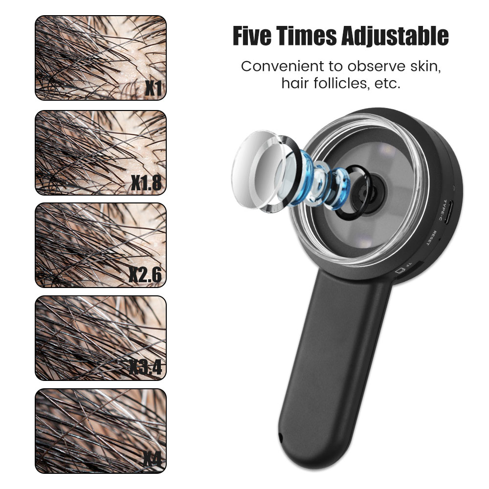 ハンドヘルド皮膚鏡、100倍拡大皮膚および頭皮アナライザー、 - Hair Porosity Test のレビューと価格